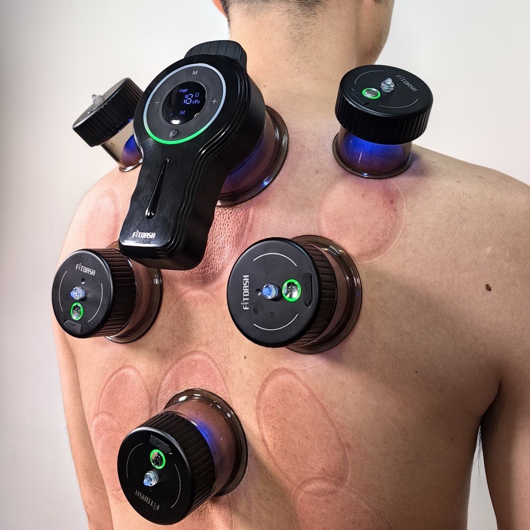 Appareil de cupping électrique utilisé à domicile dans le Grand Genève