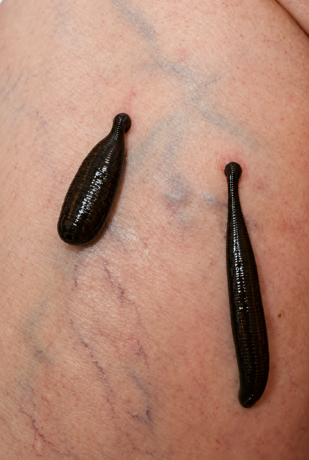 Sangsue médicinale sur peau